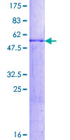 12.5% SDS-PAGE Stained with Coomassie Blue.